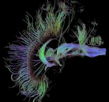 Wanderings of the Young Brain