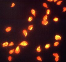 Giardia