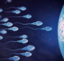 Infertility