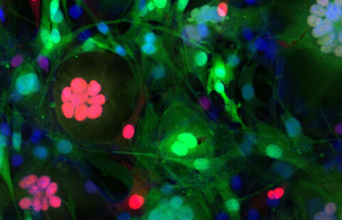 Stem Cells