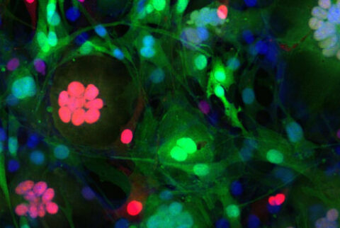 Stem Cells