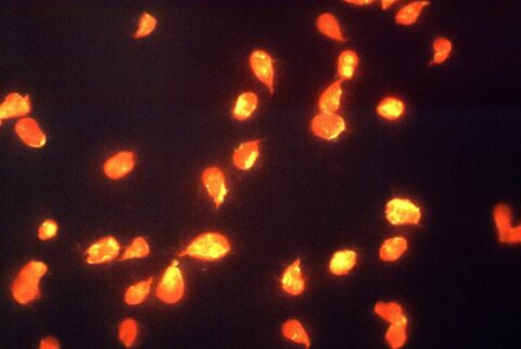 Giardia